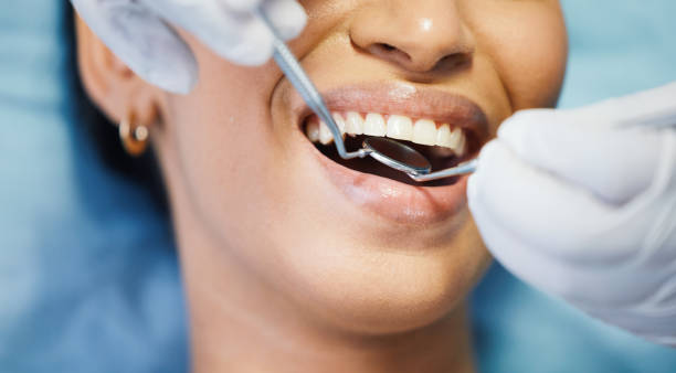 Best Emergency Dentist for Lost Fillings or Crowns in Pinetops, NC