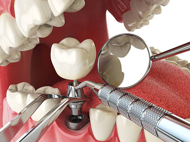 Best Emergency Dentist for Knocked-Out Tooth in Pinetops, NC